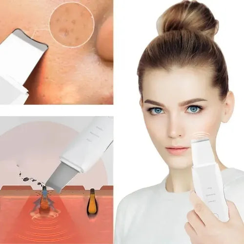 Paleta ultrasonica + Serum facial de regalo 🎁