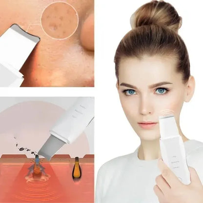 Paleta ultrasonica + Serum facial de regalo 🎁